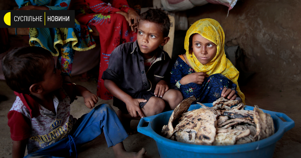 Голодающие люди в Йемене. Бедные страны дети голодающих.